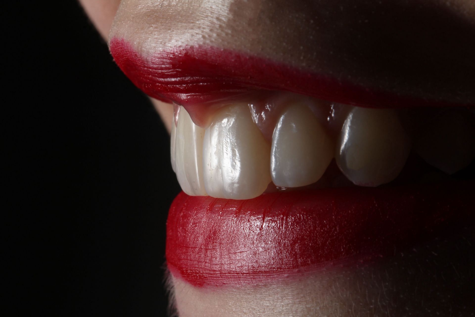Bright white teeth (Image via Unsplash/Rafael)