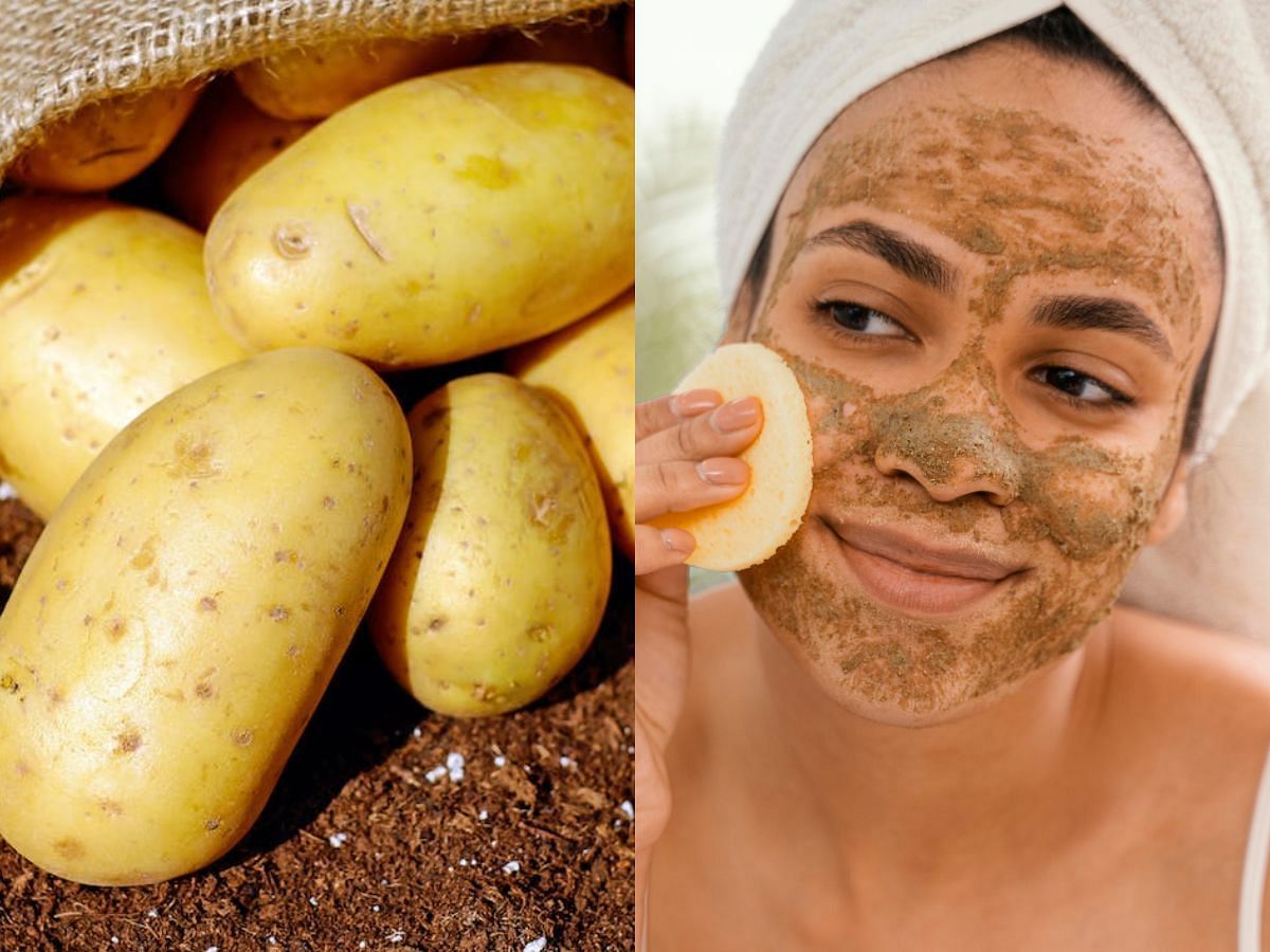 Skin benefits of Potato: How to use it for pigmentation, skin whitening,  and more