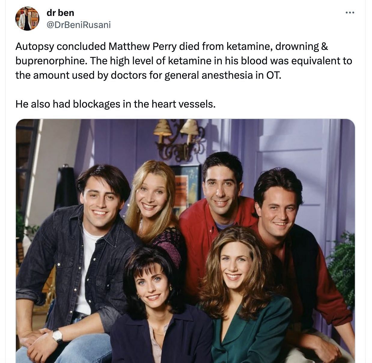 The cause of death of the FRIENDS actor was revealed. (Image via X/ @drbenirusani)