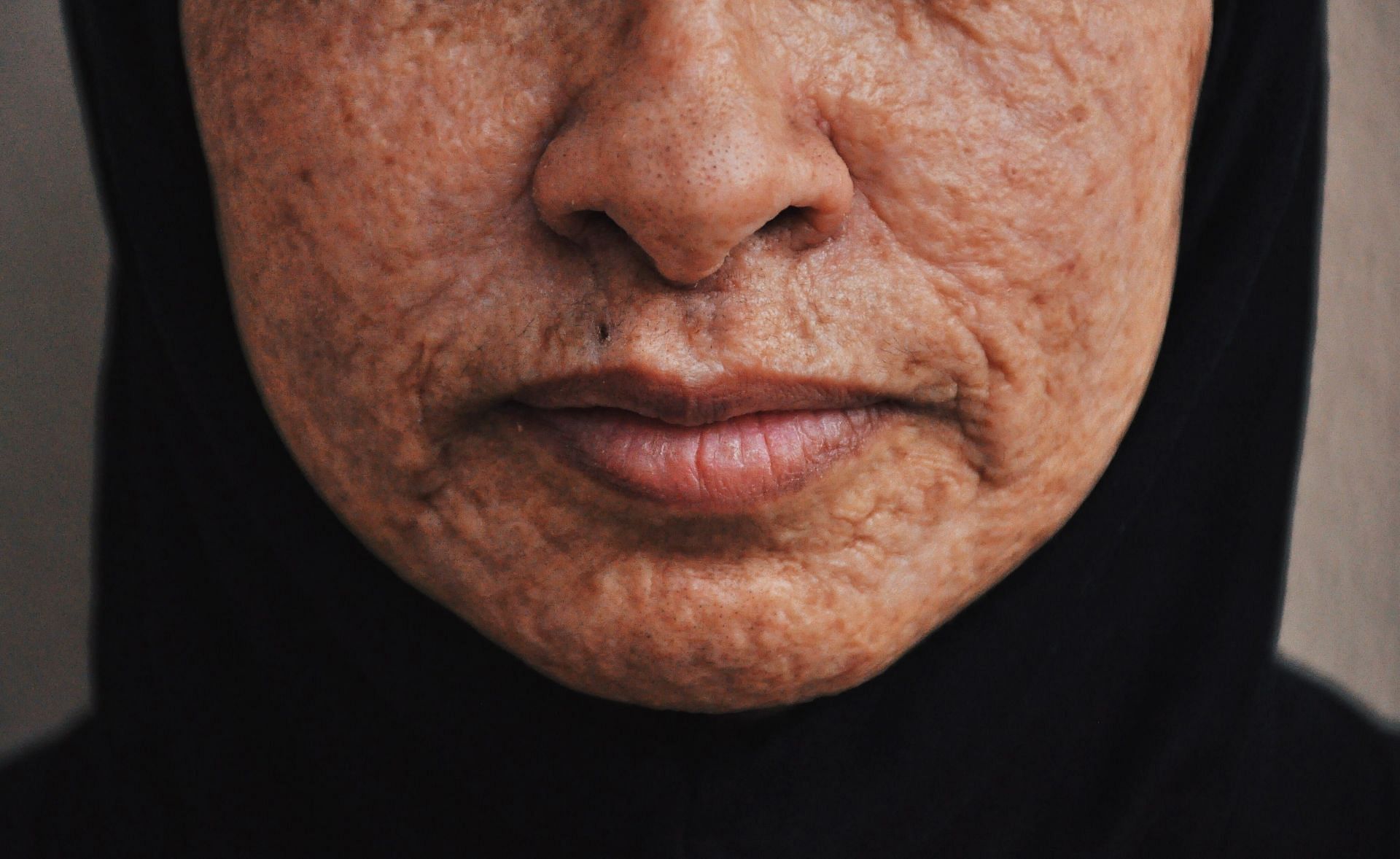 benefits of Vitamin E capsules for scars (image sourced via Pexels / Photo by andy)