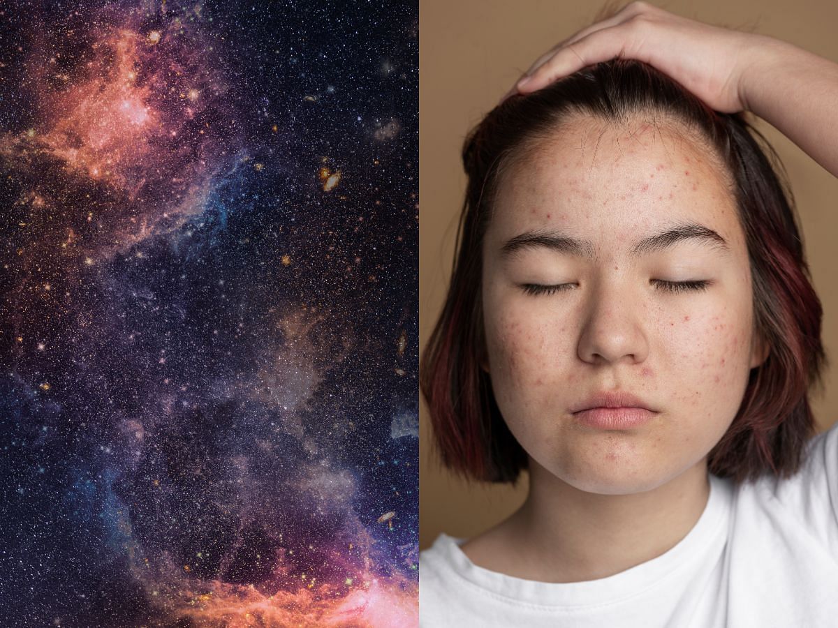 Does Mercury Retrograde affect your skin? Myths and facts explained