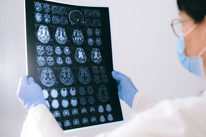 8 actors with Alzheimer's you need to know about