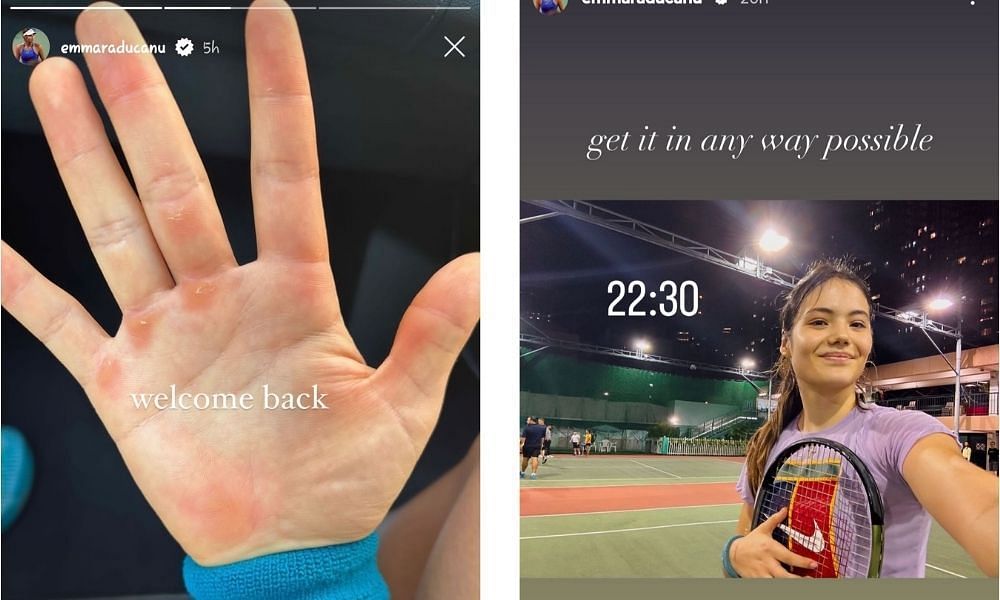 Emma Raducanu shares image of her sore hands