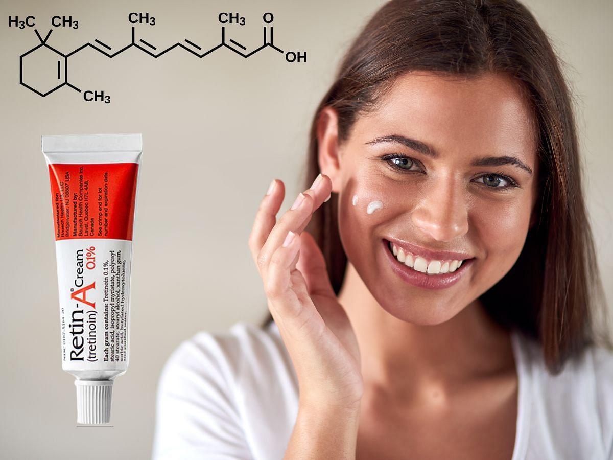 How to use tretinoin cream for wrinkles (Image via Sportskeeda)