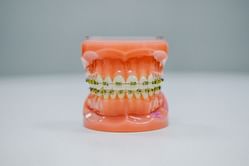 Periodontitis Symptoms That Might Become the Reason of Your Next Dentist Visit