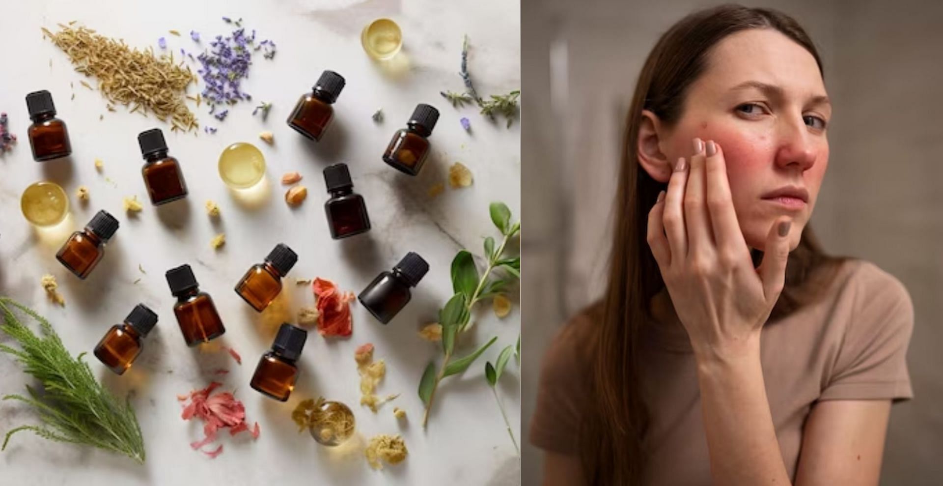 7 natural remedies to relieve any skin irritation