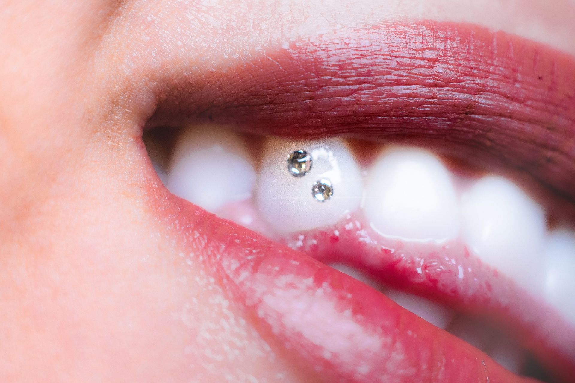 Bright white teeth (Image via Unsplash/Luigi)