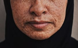 Try out these effective ways of reverse aging to look younger