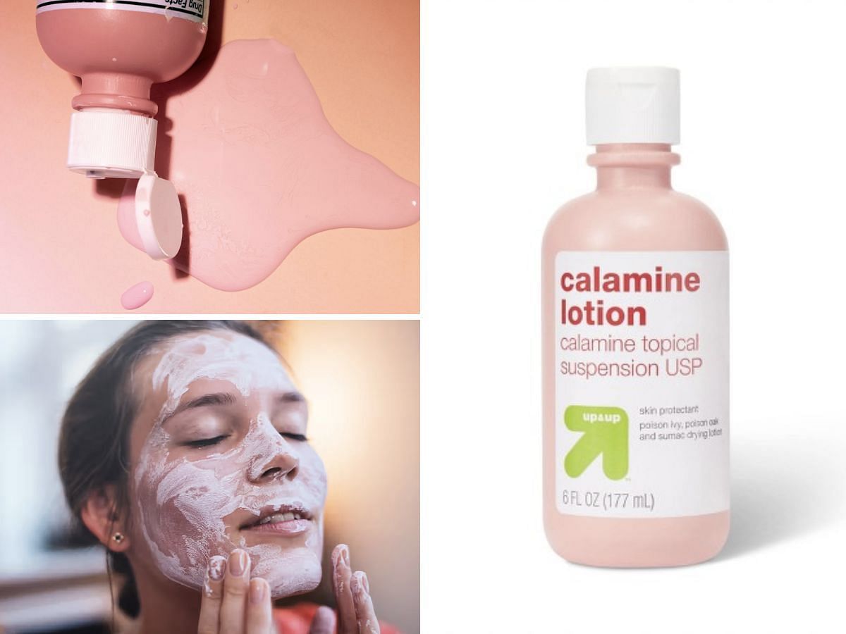 Calamine lotion as a multipurpose skincare product (Image via Sportskeeda)