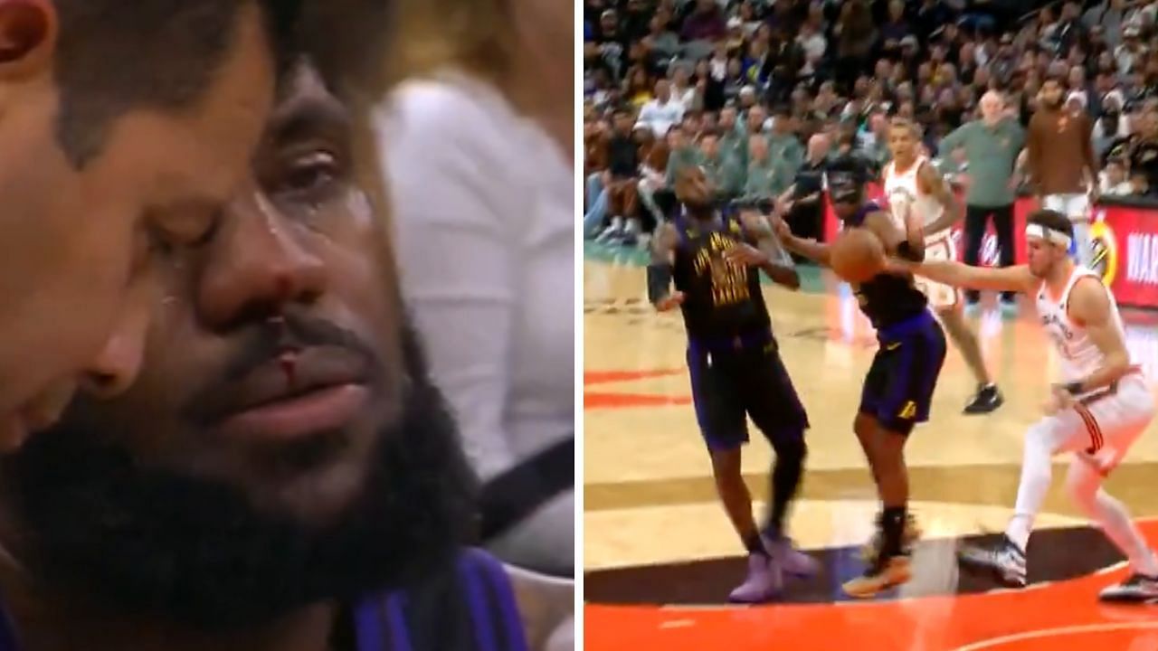 LeBron James gets inadvertently elbowed in the face by Rui Hachimura leaving 4x MVP bleeding  