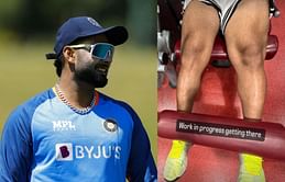 Rishabh Pant shares picture of scar on leg a year after horrific car accident