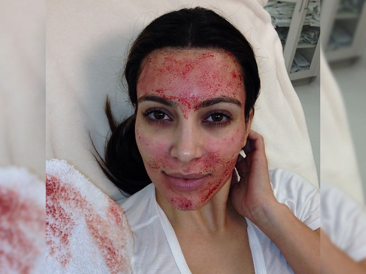 11 most expensive celebrity beauty treatments