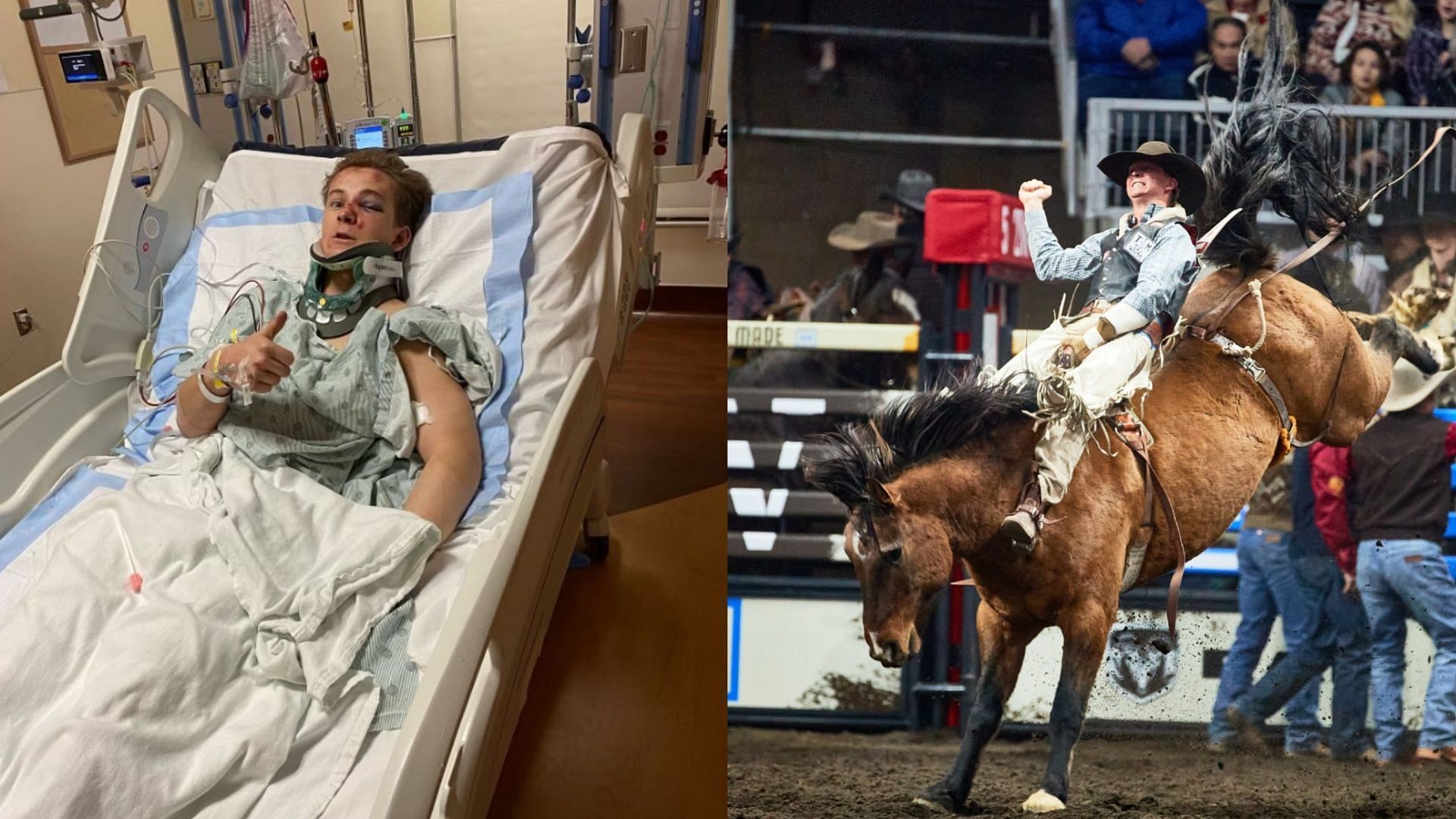 What happened to Austin Broderson?  A case where a bareback bronze rider suffered horrific injuries was explored in a video related to the incident