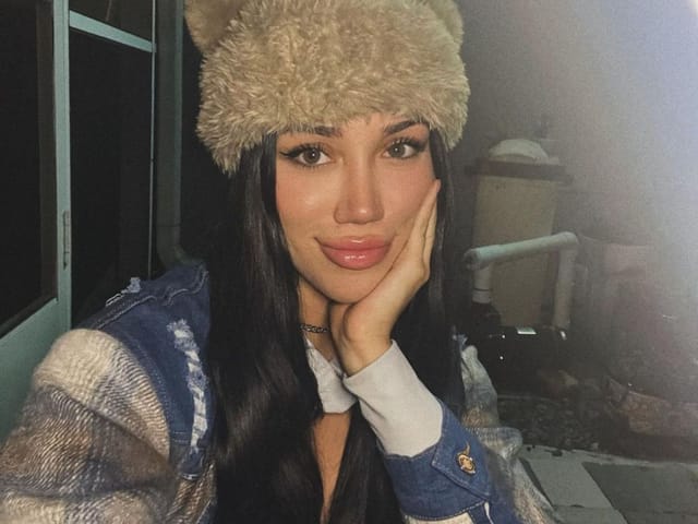 moriah the challenge nose job Image 6