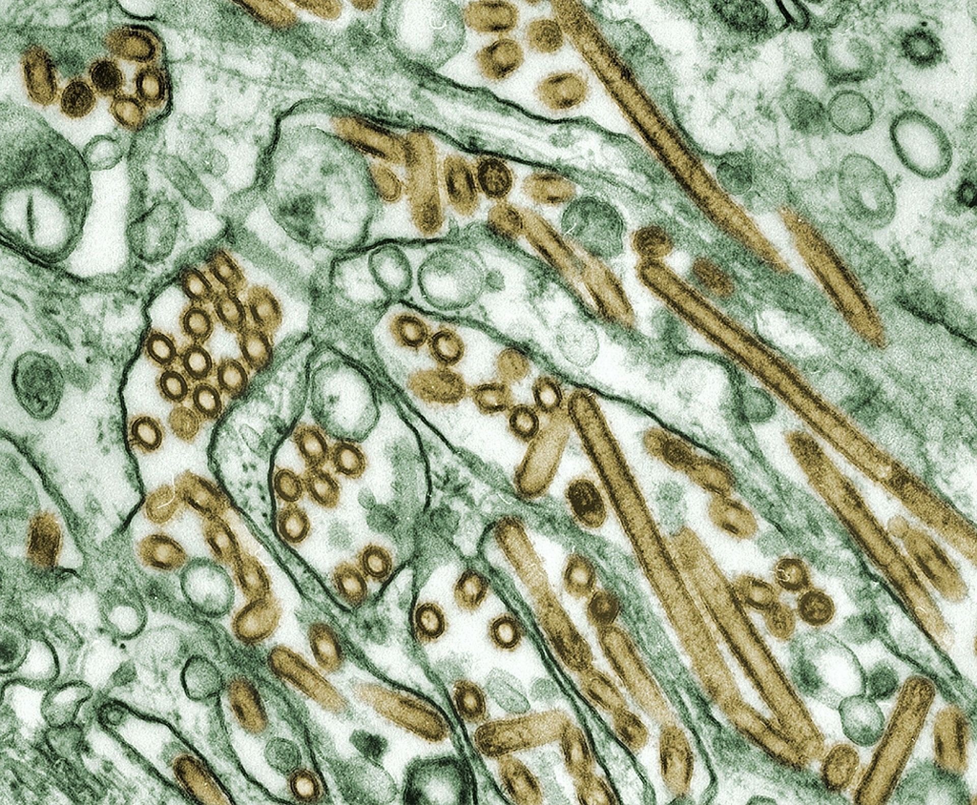 Virus (Image via Unsplash/CDC)