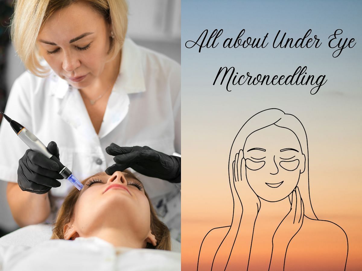 Everything you need to know about under eye microneedling (Image via Sportskeeda)