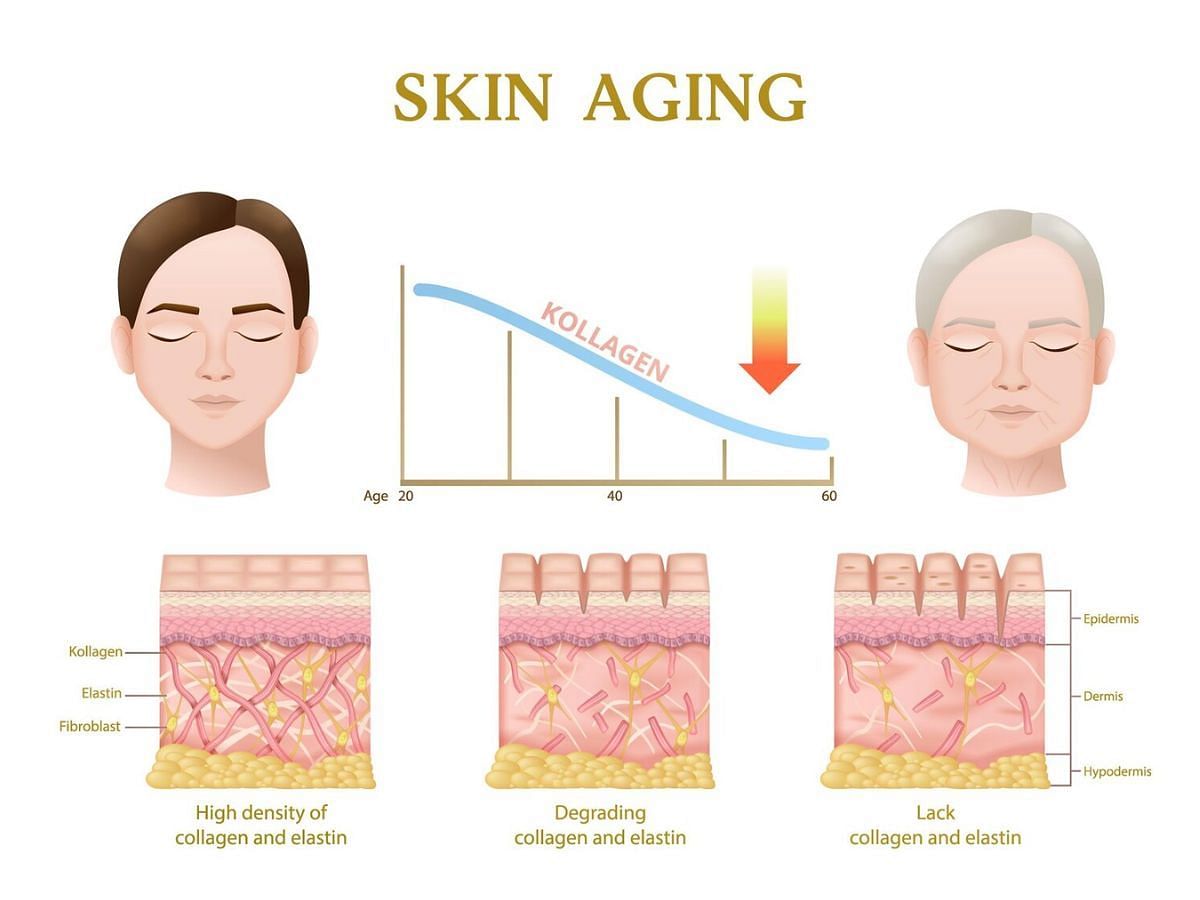 Collagen depletion (image via Freepik)