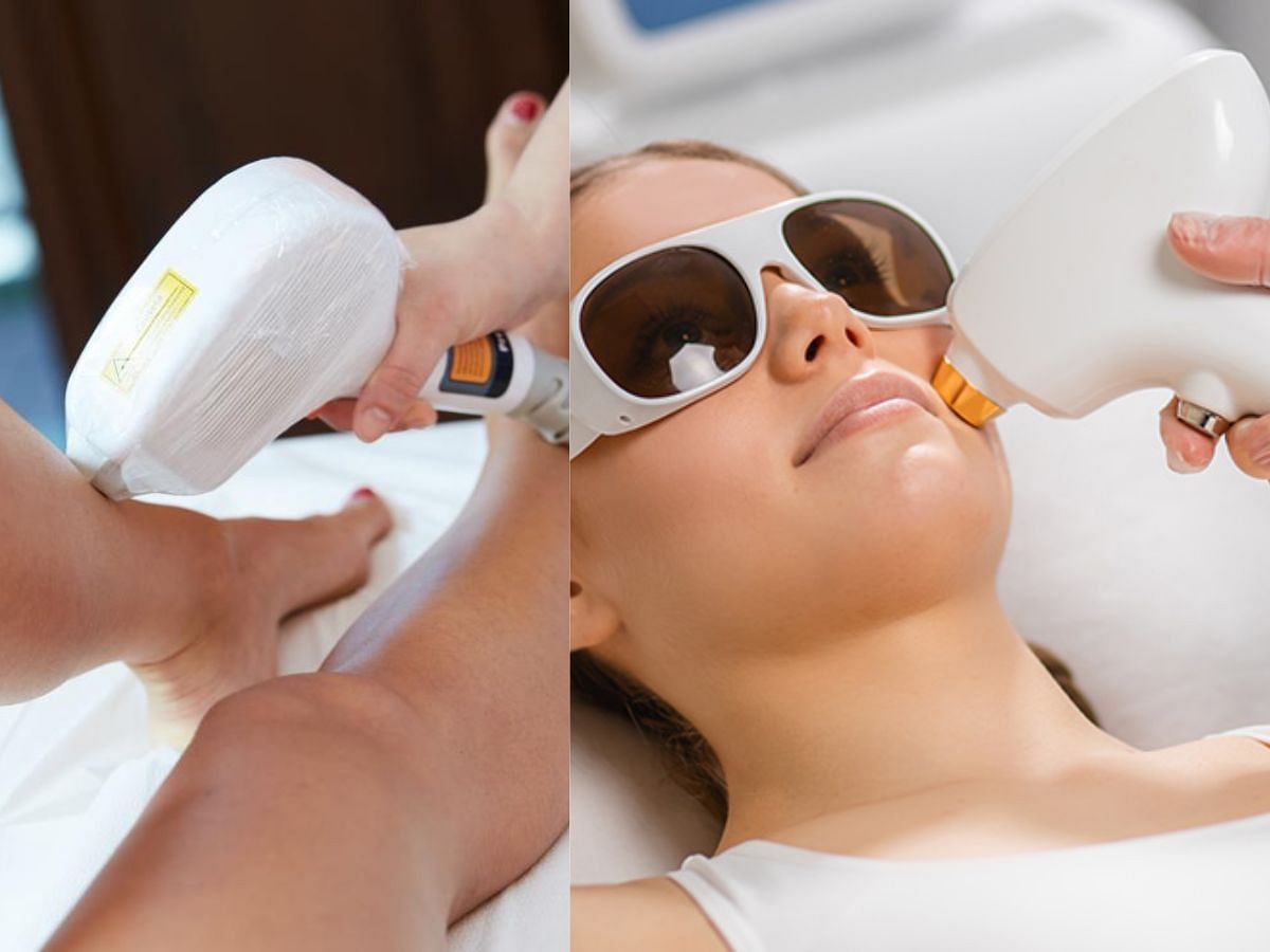 How painful is laser hair removal Everything you need to know