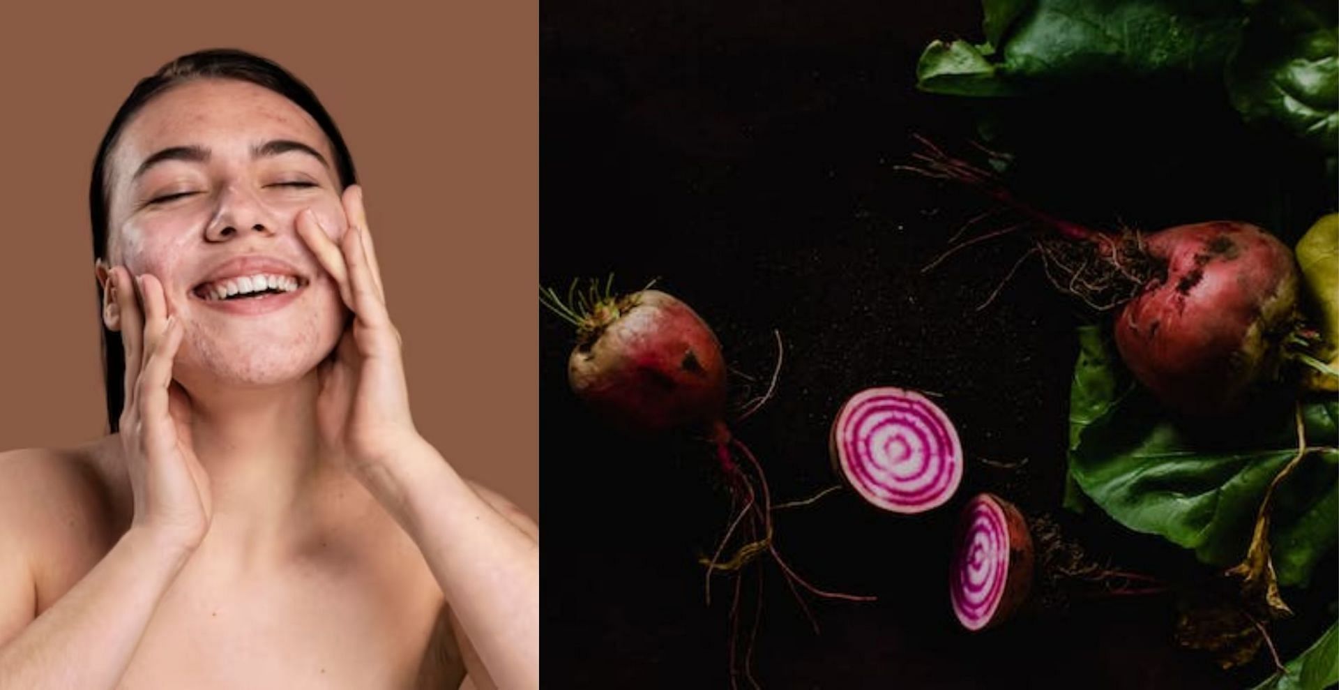 7 Beetroot benefits for skin