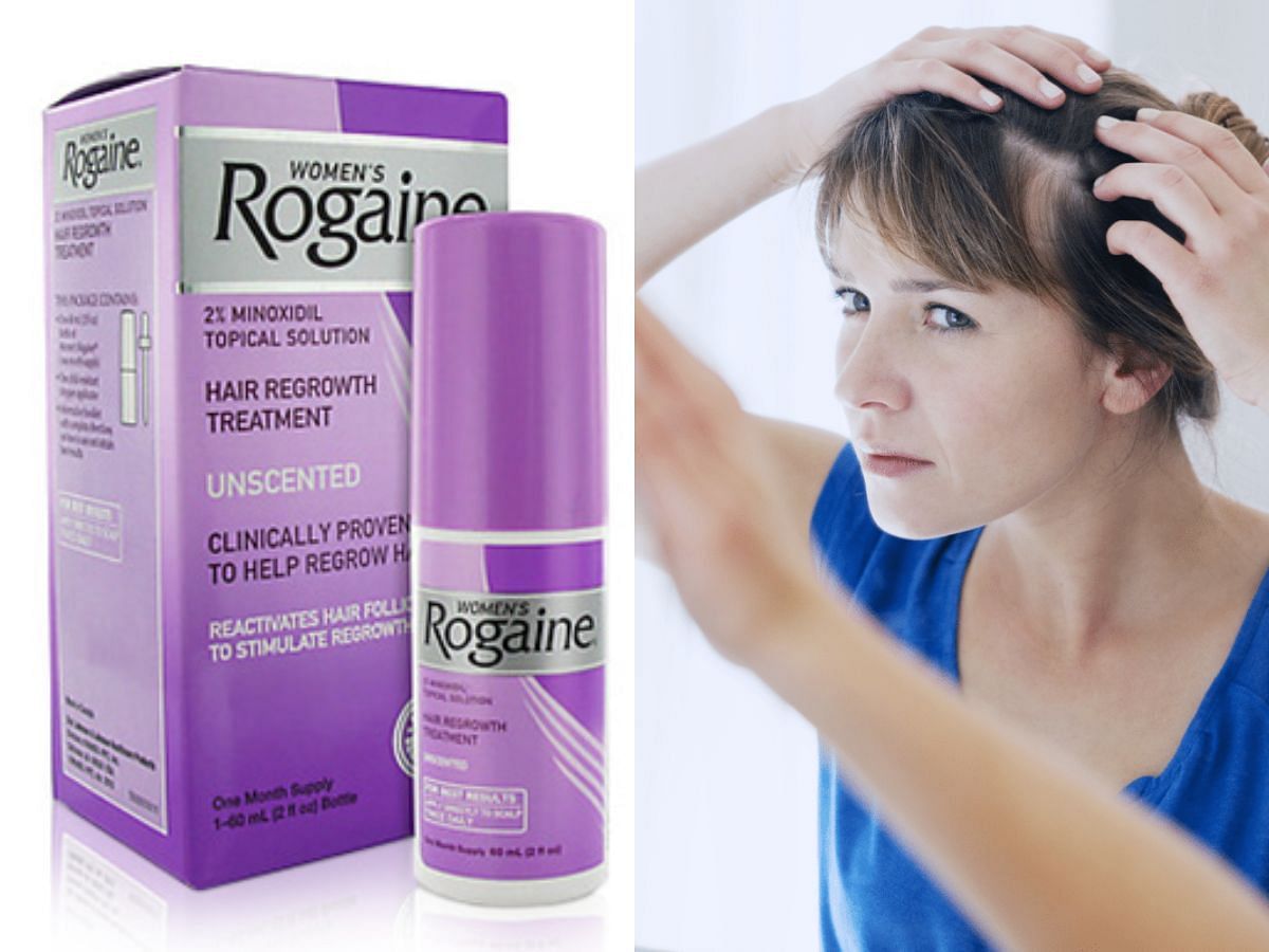 Rogaine benefits and side effects explored (Image via Sportskeeda)