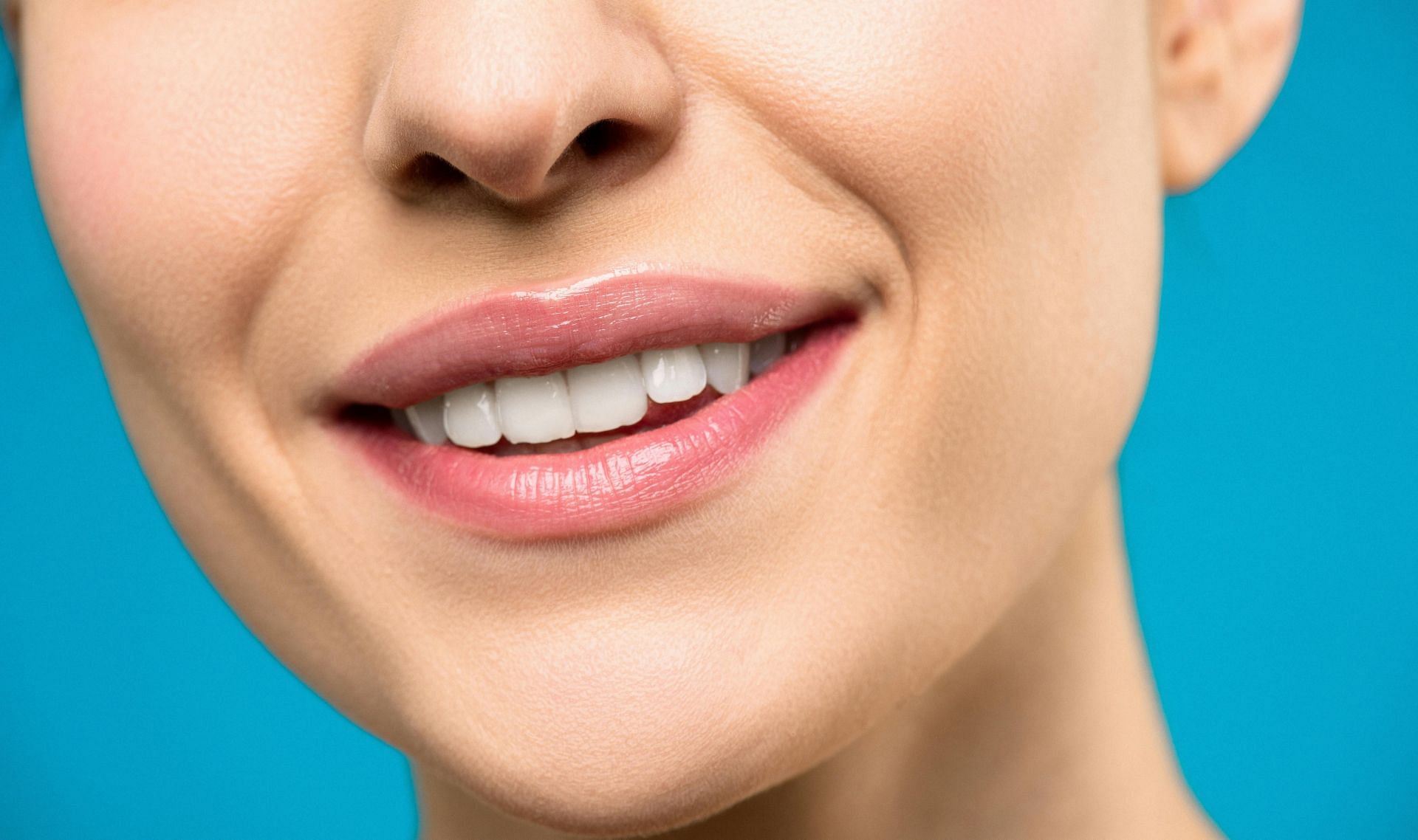 Tips on how to fix a chipped tooth (image sourced via Pexels / Photo by shiny)