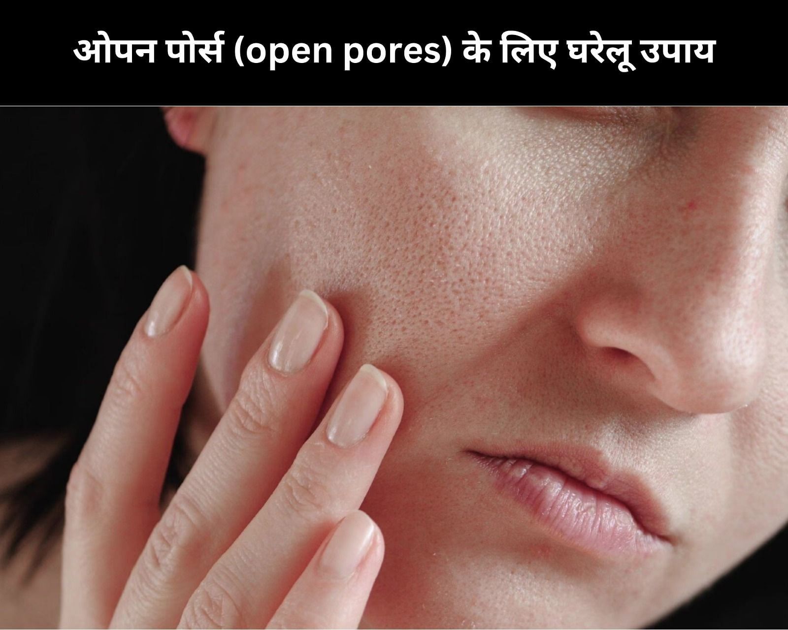 ओपन पोर्स (open pores) के लिए घरेलू उपाय (फोटो - sportskeedaहिन्दी)