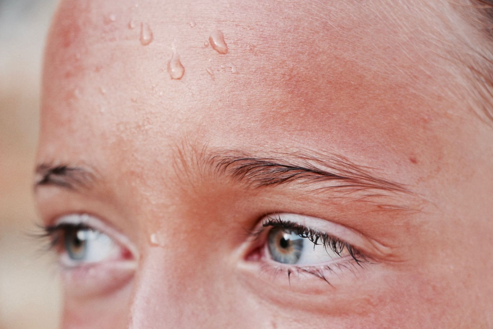 Sweating sickness (Image via Unsplash/Hans Reniers)
