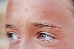 Do you have sweating sickness? Act on these symptoms before its too late