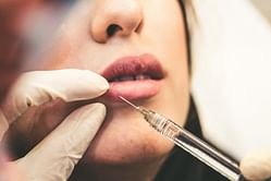China's Embassy in Seoul issues warning on South Korean Plastic Surgery - Here's why