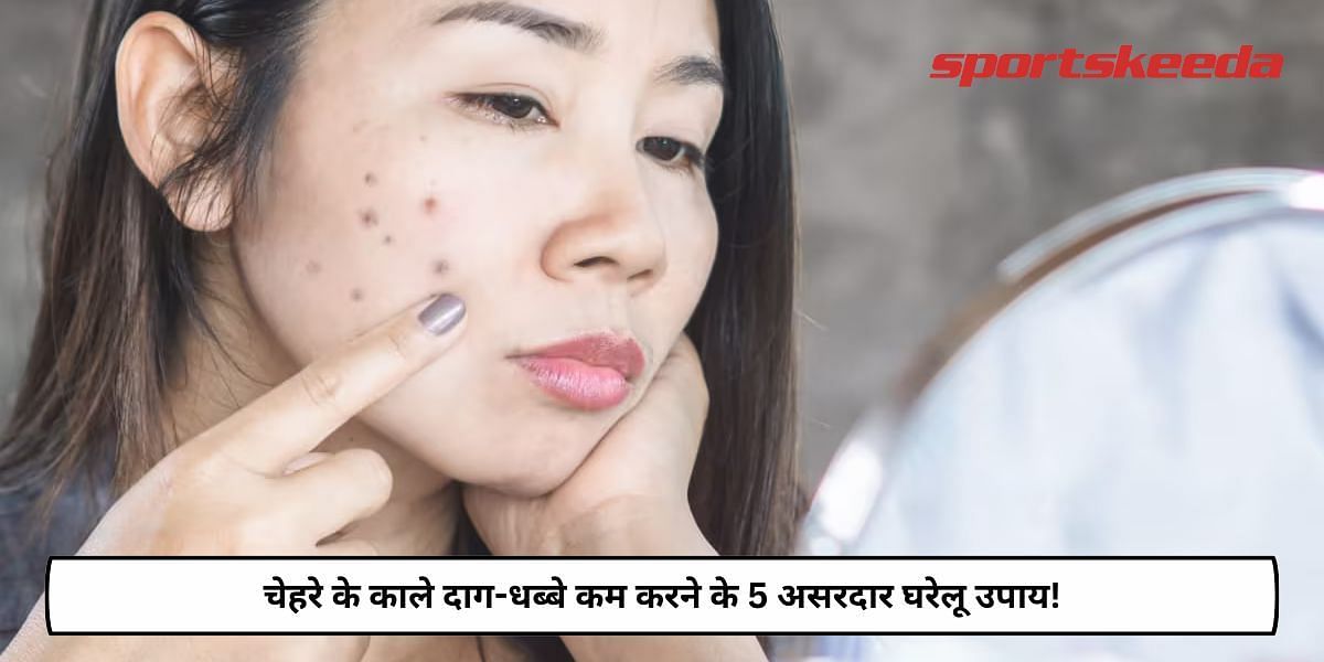 5 Effective Home Remedies To Reduce Dark Spots On Face!