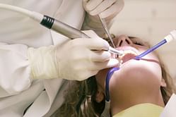 How to Fix a Chipped Tooth? 8 Effective Ways to Have Perfect Teeth