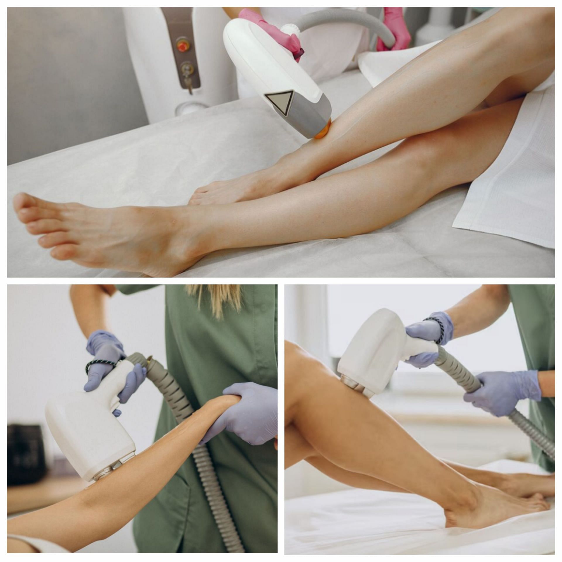 Ipl hair removal best sale cost