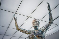 Here’s everything you need to know about thoracic outlet syndrome