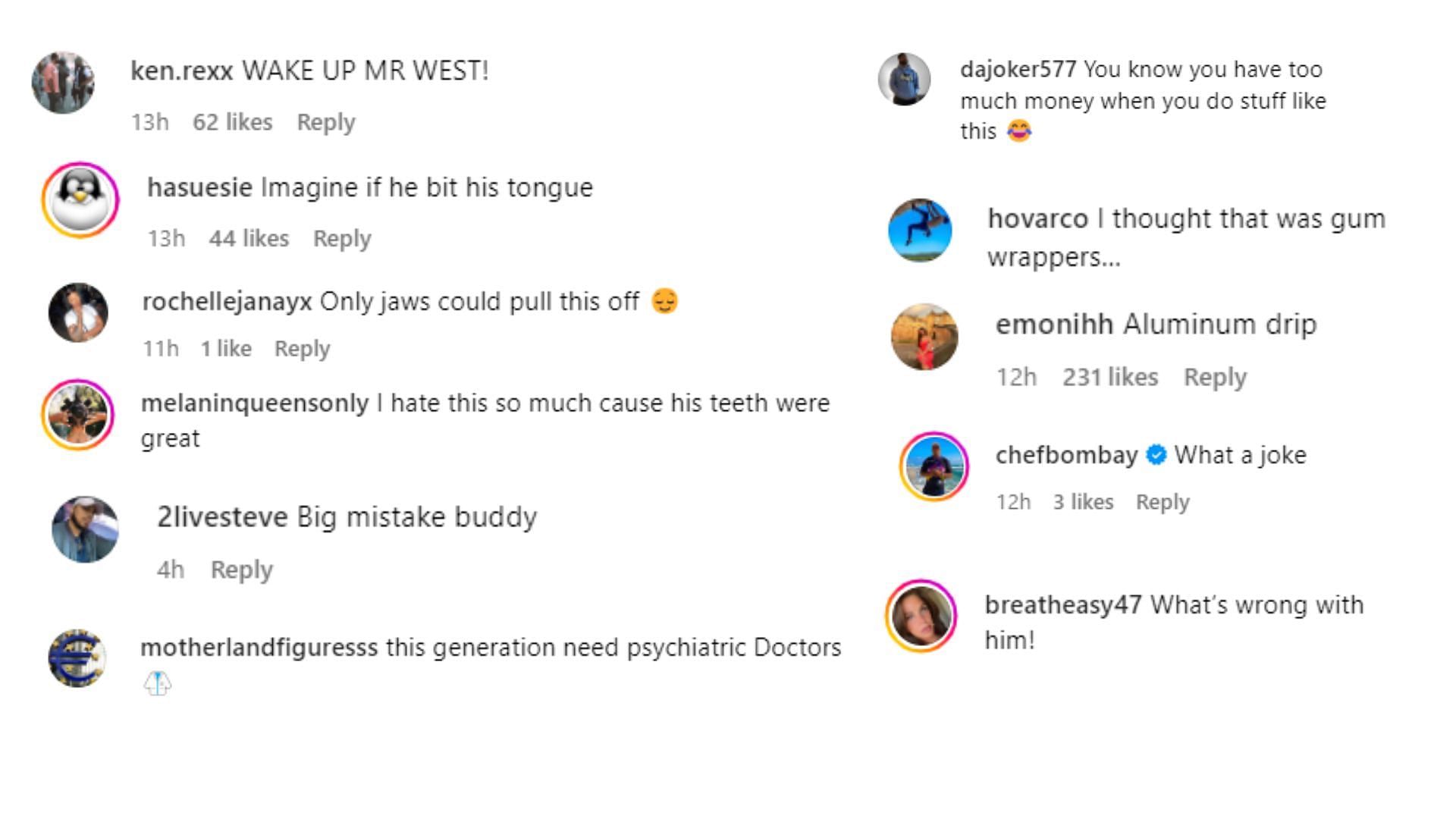 Fans shared sarcastic comments at Kanye&#039;s titanium denture ( Image via @Copoclock/ Instagram)