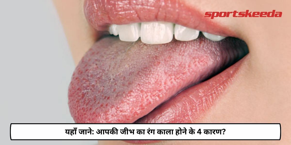 4 Reasons Why The Colour Of Your Tongue Is Dark?