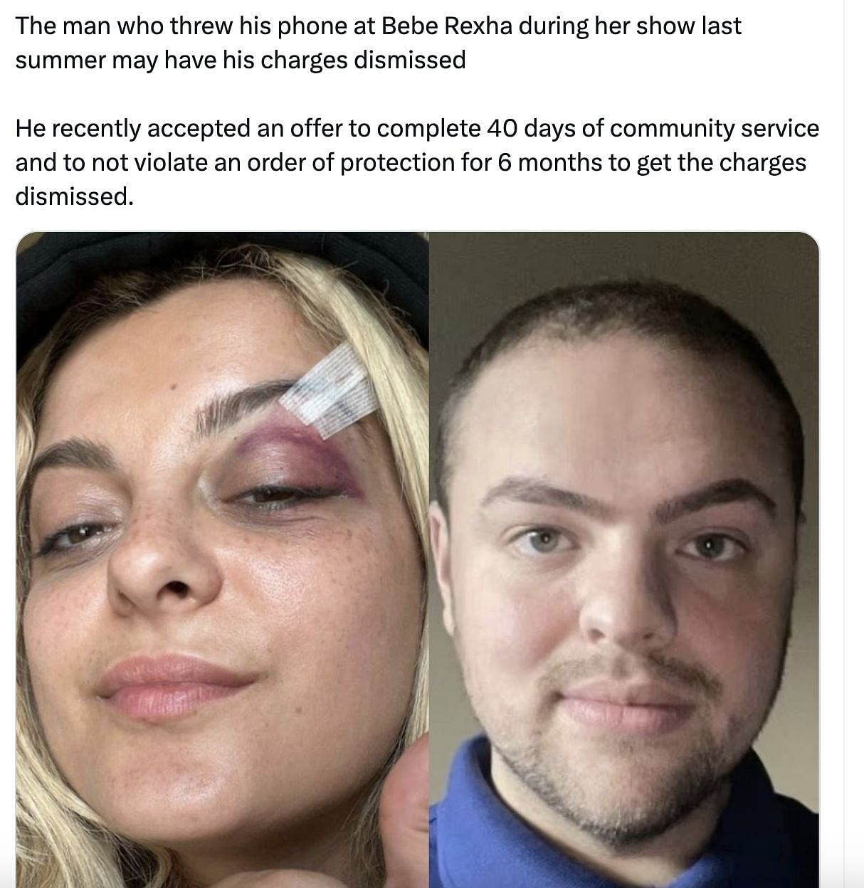 The news of Rexha&#039;s attacker&#039;s charges likely to be dismissed leaves netizens appalled: Reactions explored. (Image via @popcrave/ X)