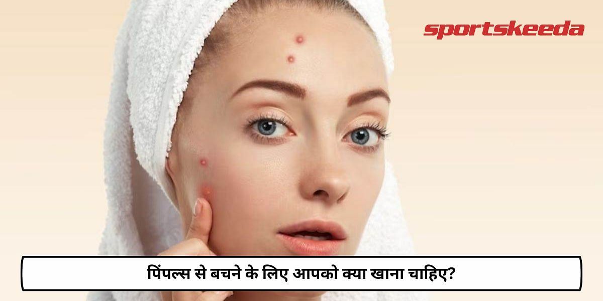 What Should You Eat To Avoid Pimples?