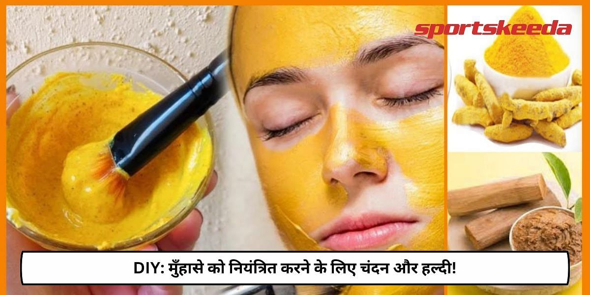 DIY: Sandalwood And Turmeric For Controlling Acne!