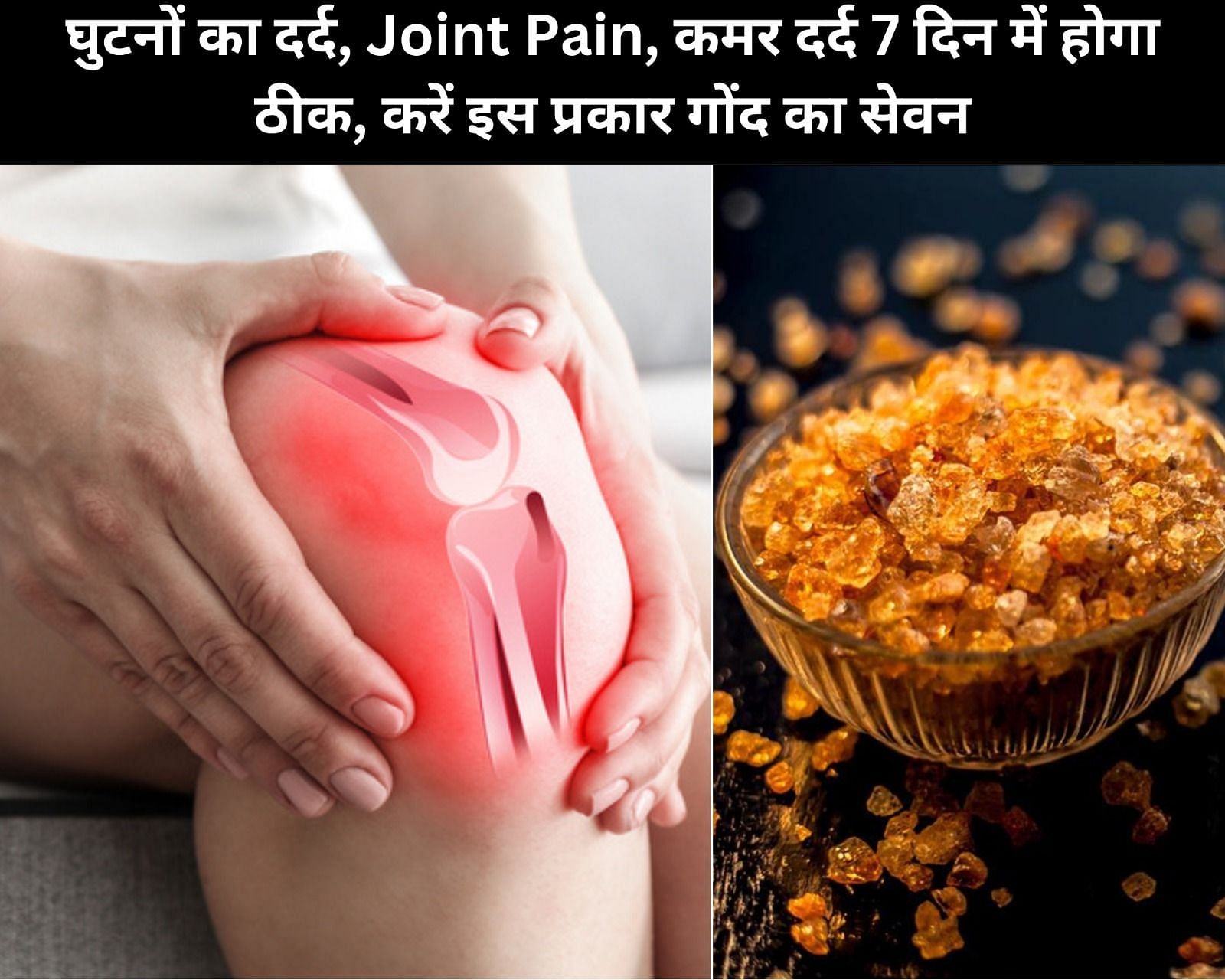 घुटनों का दर्द, Joint Pain, कमर दर्द 7 दिन में होगा ठीक, करें इस प्रकार गोंद का सेवन (फोटो - sportskeedaहिन्दी)