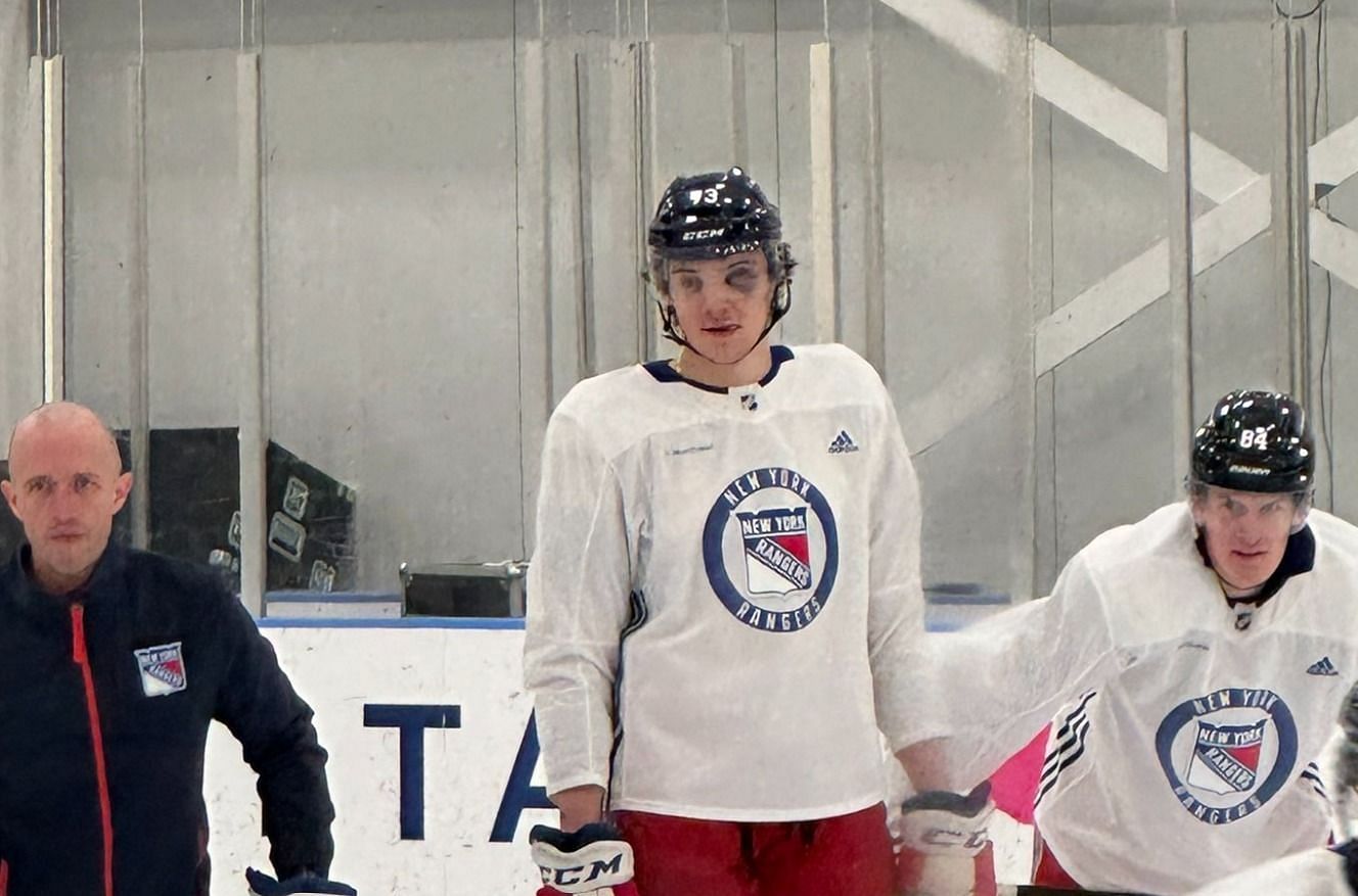 NHL fans react to Matt Rempe sporting a black eye in practice