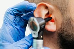 Here's how you can get rid of Crusty Ears