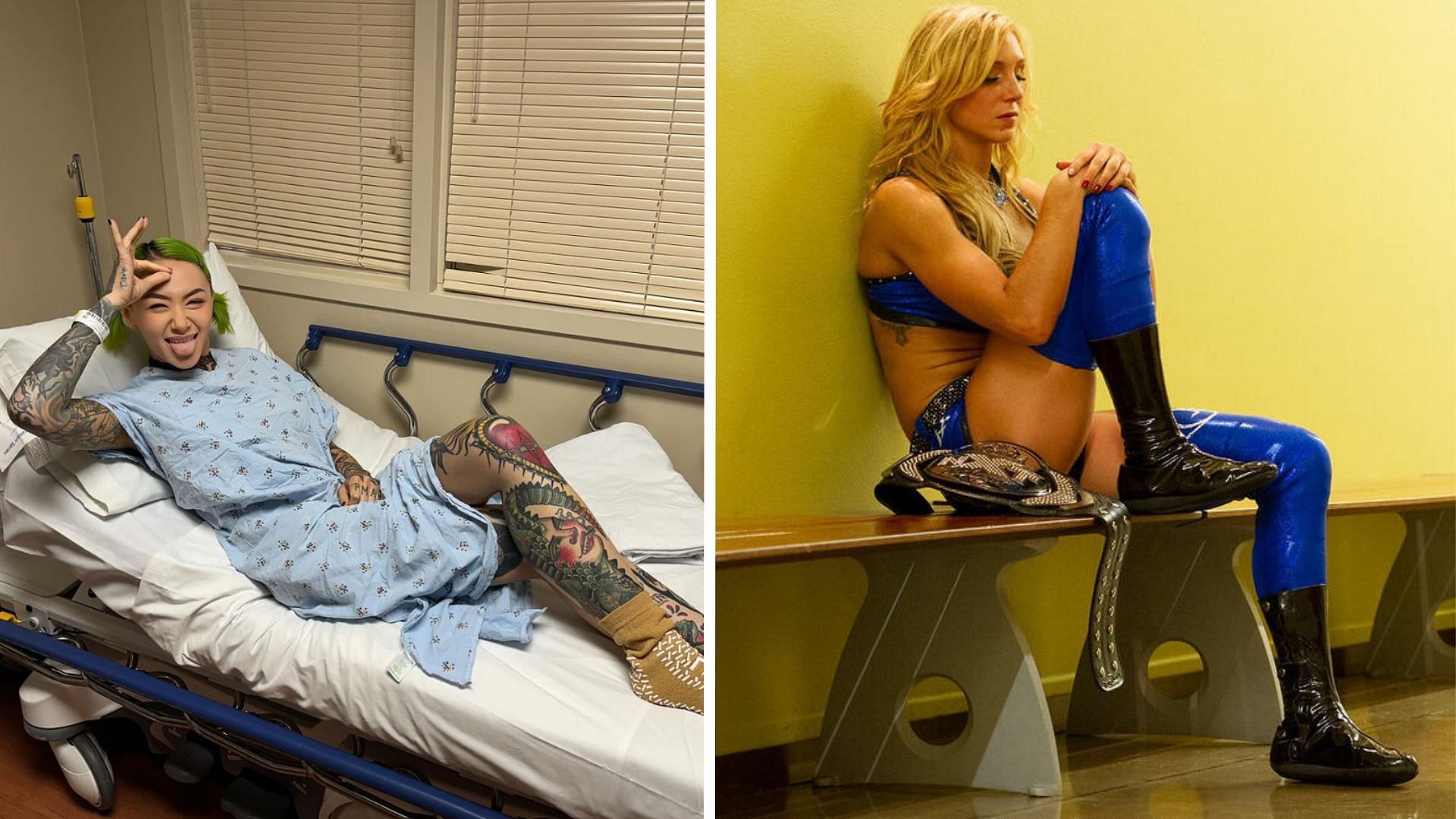 Several female WWE stars are out with a torn ACL