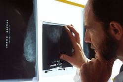 10 most common cancers in men