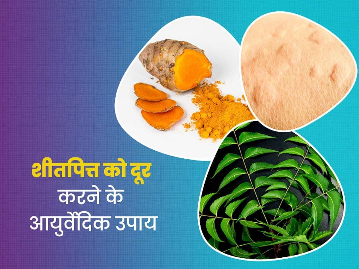 शीतपित्त के दाने निकलने पर अपनाएं ये घरेलू उपचार (sportskeeda Hindi) 
