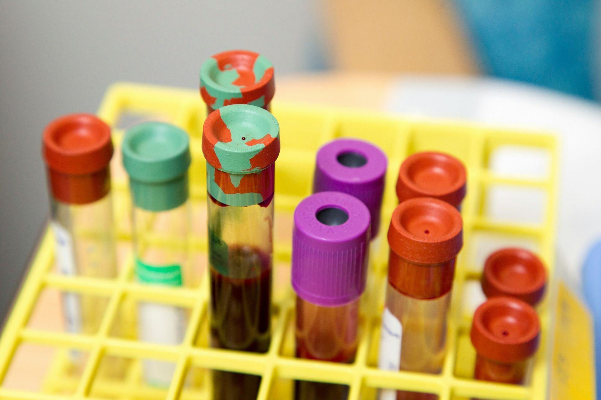 Blood samples to test for alcoholic neuropathy (Image by NCI/Unsplash)
