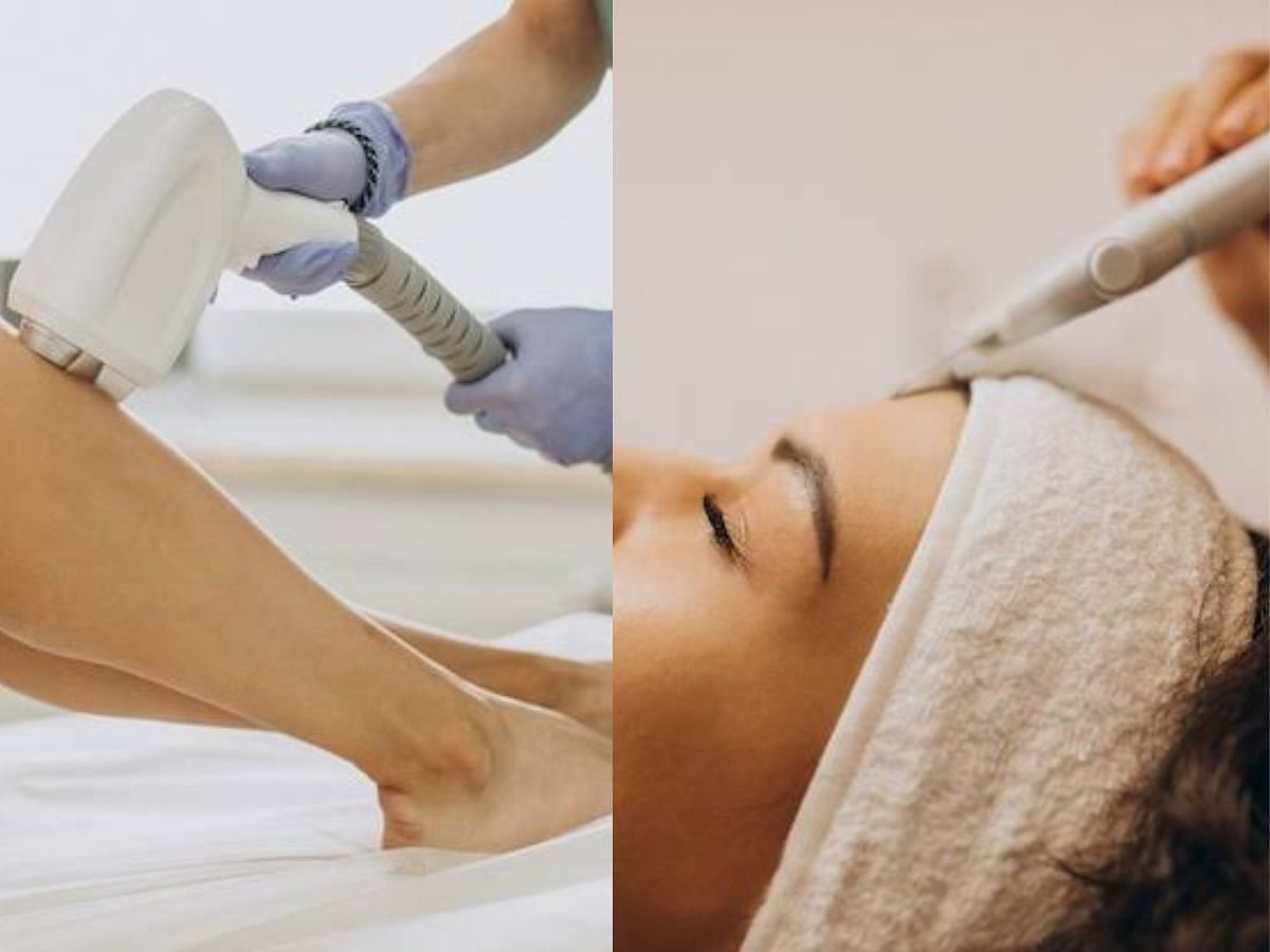 Electrolysis vs laser hair removal (Image via freepik.com)