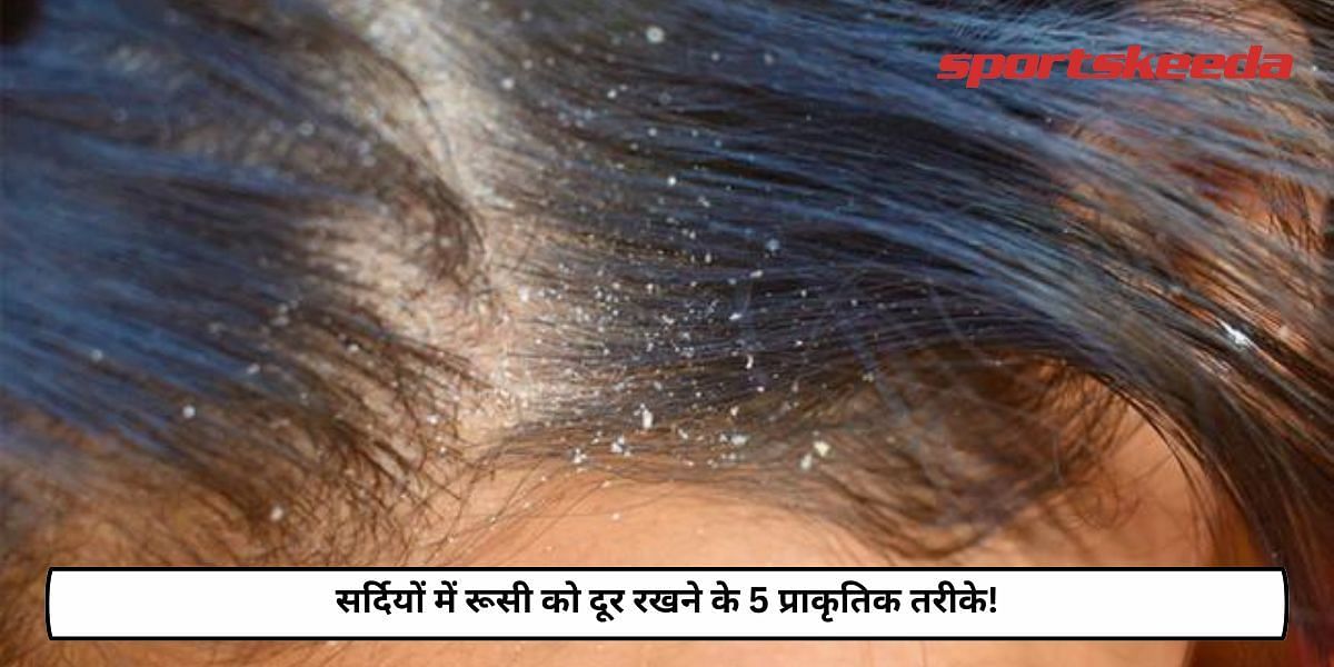 5 Natural Ways To Keep Dandruff Away In Winters!
