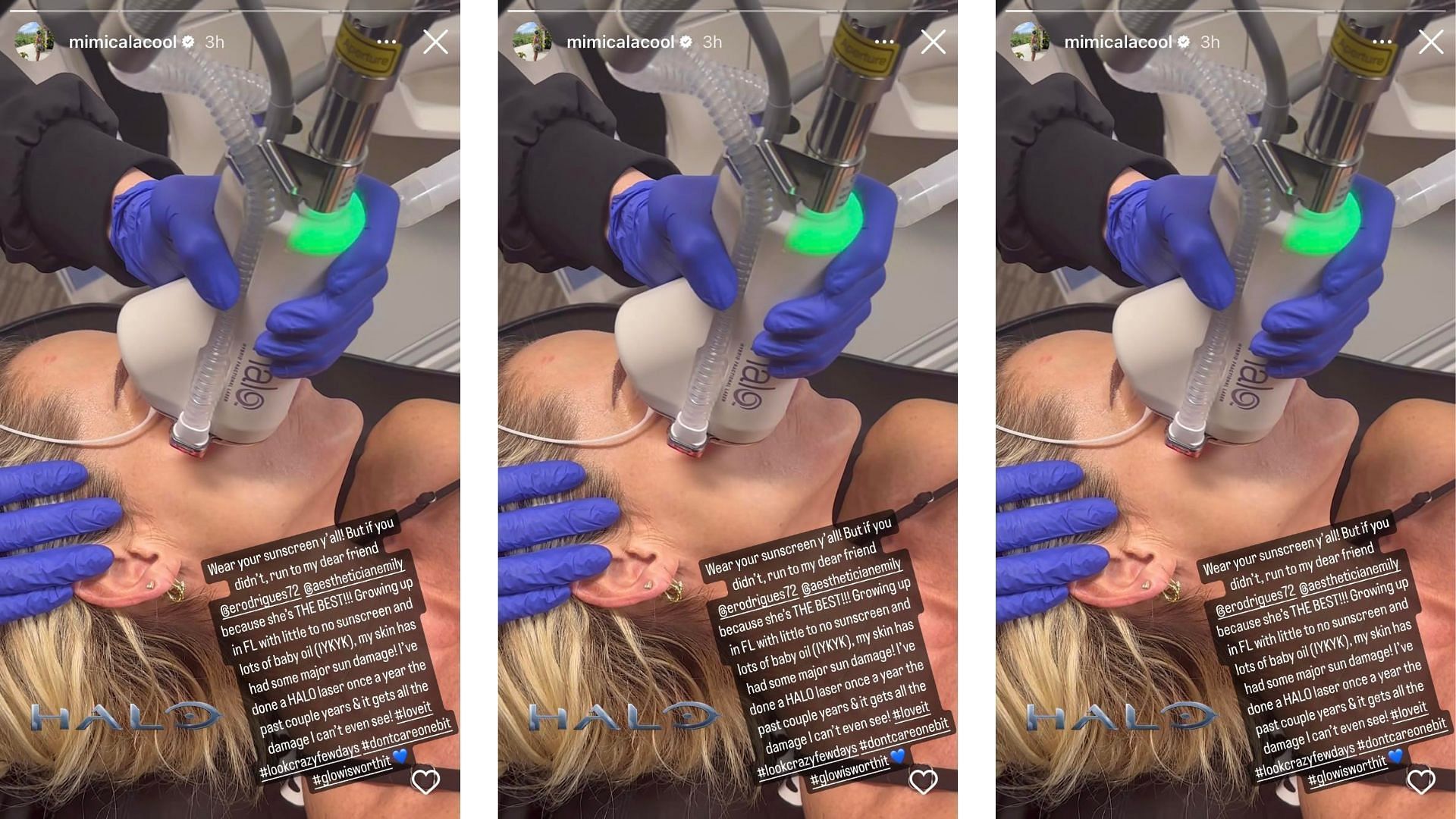 McCool shares video of brutal procedure on Instagram.