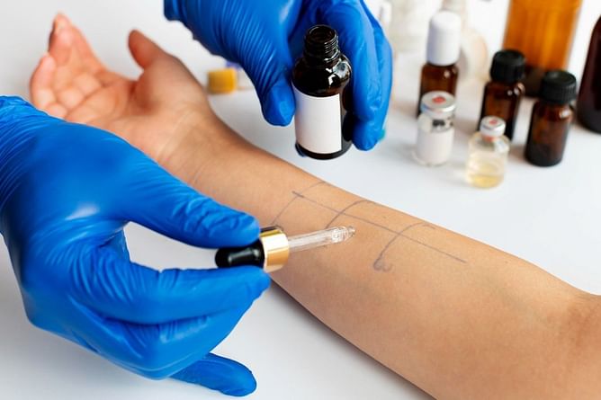 Is Salicylate Allergy a Condition You Should be Worried About?