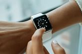 Does Apple Watch cause rashes? Here's how to get rid of it